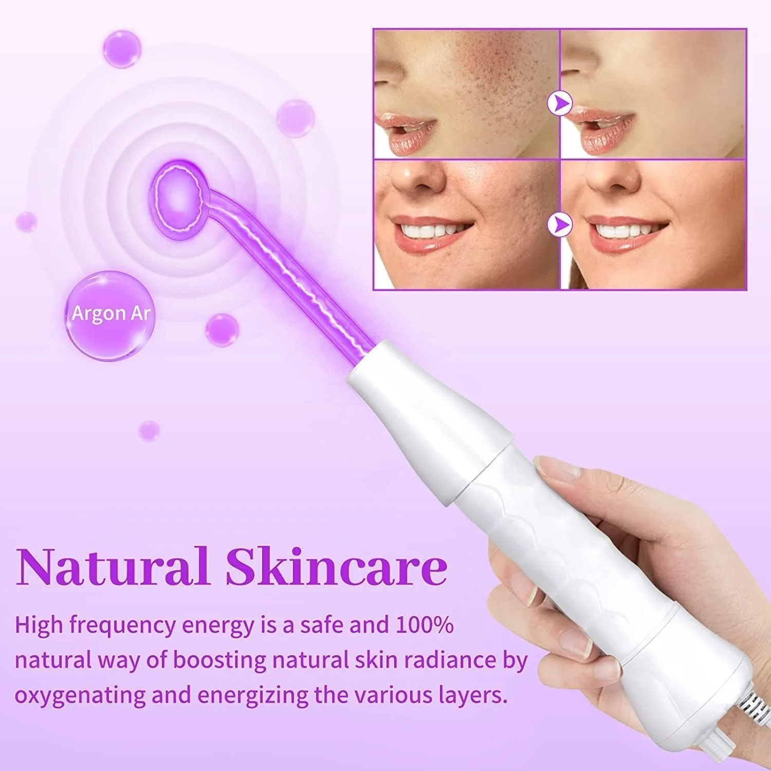 High Frequency Facial Wand 4-Piece Set Wrinkle & Anti-Aging Device White DEMO - Image 2