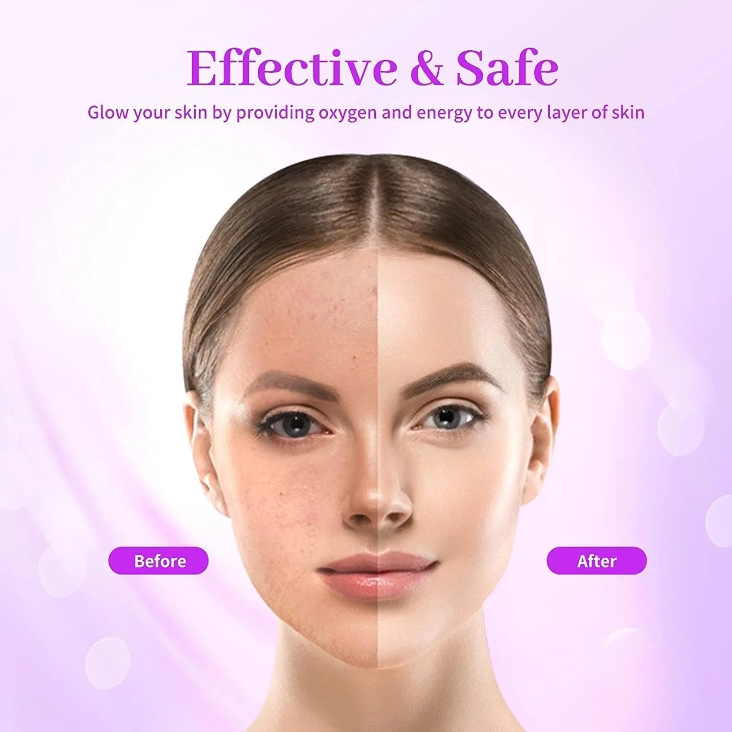 High Frequency Facial Wand 4-Piece Set Wrinkle & Anti-Aging Device White DEMO - Image 7
